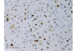 Immunohistochemistry of paraffin-embedded mouse liver using PCNA antibody (ABIN5970094) at dilution of 1/100 (40x lens). (PCNA antibody)