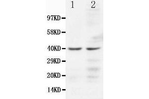 Anti-CCR5 antibody, Western blotting Lane 1: JURKAT Cell Lysate Lane 2: COLO320 Cell Lysate