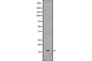 Western blot analysis of UBE2D3 expression in Hela cell lysate,The lane on the left is treated with the antigen-specific peptide.