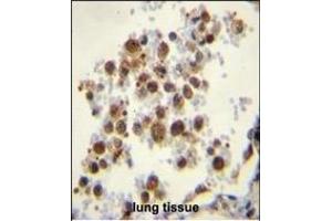 CYP5A1 Antibody (Center) (ABIN656016 and ABIN2845391) immunohistochemistry analysis in formalin fixed and paraffin embedded human lung tissue followed by peroxidase conjugation of the secondary antibody and DAB staining. (TBXAS1 antibody  (AA 226-257))