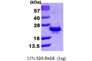 SDS-PAGE (SDS) image for Sorcin (SRI) (AA 1-198) protein (His tag) (ABIN667371) (SRI Protein (AA 1-198) (His tag))