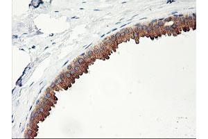 Immunohistochemical staining of paraffin-embedded Human breast tissue using anti-PHF21B mouse monoclonal antibody. (PHF21B antibody)