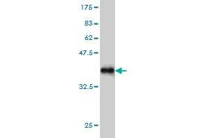 Western Blot detection against Immunogen (37. (SIK2 antibody  (AA 467-576))