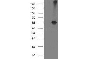 HEK293T cells were transfected with the pCMV6-ENTRY control (Left lane) or pCMV6-ENTRY ADH1B (Right lane) cDNA for 48 hrs and lysed. (ADH1B antibody)