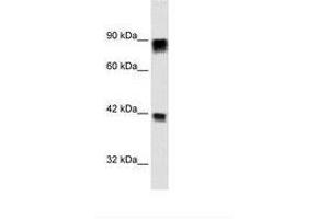 Image no. 1 for anti-Retinoblastoma Protein (Rb Protein) (AA 703-752) antibody (ABIN6735939) (Retinoblastoma Protein (Rb) antibody  (AA 703-752))