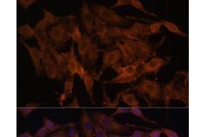 Immunofluorescence analysis of HeLa cells using TLR3 Polyclonal Antibody at dilution of 1:100. (TLR3 antibody)