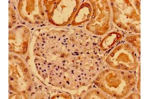 Immunohistochemistry of paraffin-embedded human kidney tissue using ABIN7160238 at dilution of 1:100 (SMAD4 antibody  (AA 27-195))