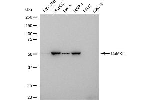Western blotting analysis using CaMKII antibody (ABIN7797837).