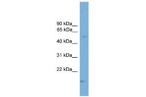 WB Suggested Anti-CDS1 Antibody Titration:  0.