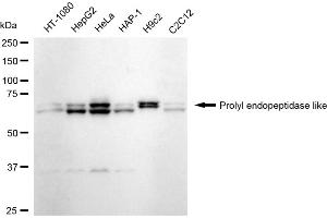 Western blotting analysis using Prolyl endopeptidase like antibody (ABIN7799922).