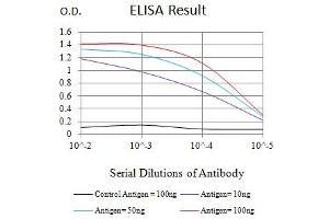 Black line: Control Antigen (100 ng),Purple line: Antigen (10 ng), Blue line: Antigen (50 ng), Red line:Antigen (100 ng) (MSH6 antibody  (AA 217-395))