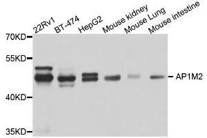 Western blot analysis of extracts of various cell lines, using AP1M2 antibody.