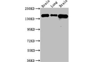 Western Blot Positive WB detected in: Rat Brain whole cell lysate, Rat Lung whole cell lysate, Mouse Brain whole cell lysate All lanes: FGFR2 Antibody at 1:1000 Secondary Goat polyclonal to rabbit IgG at 1/50000 dilution Predicted band size: 93, 87, 93, 77, 92, 89, 86, 29, 80, 93, 97, 92, 41, 80, 80, 77, 80 kDa Observed band size: 145 kDa (Recombinant FGFR2 antibody)
