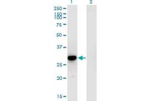 RFXANK antibody  (AA 1-90)