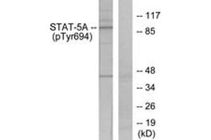 Western blot analysis of extracts from HeLa cells treated with EGF, using STAT5A (Phospho-Tyr694) Antibody. (STAT5A antibody  (pTyr694))