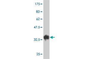 Western Blot detection against Immunogen (38. (TAF5L antibody  (AA 1-117))