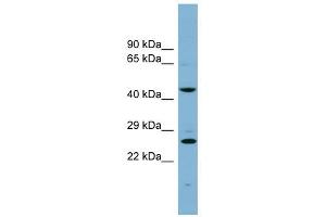 VPS28 antibody used at 1 ug/ml to detect target protein. (VPS28 antibody)
