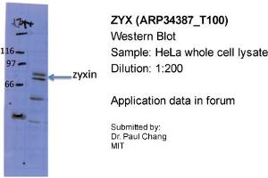 Sample Type: HeLa whole cell lysatePrimary Dilution: 1:200 (ZYX antibody  (Middle Region))