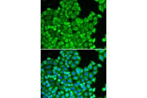 Immunofluorescence analysis of HeLa cell using CSRP1 antibody.