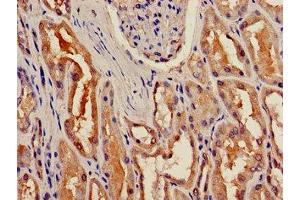 Immunohistochemistry of paraffin-embedded human kidney tissue using ABIN7153530 at dilution of 1:100 (BBOX1 antibody  (AA 154-247))