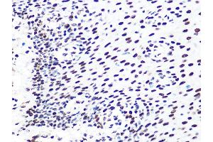 Immunohistochemistry of paraffin-embedded human esophageal using DDB1 Rabbit mAb (ABIN7266673) at dilution of 1:100 (40x lens). (DDB1 antibody)