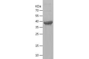 Western Blotting (WB) image for SMAD, Mothers Against DPP Homolog 3 (SMAD3) (AA 33-178) protein (His-IF2DI Tag) (ABIN7283239) (SMAD3 Protein (AA 33-178) (His-IF2DI Tag))