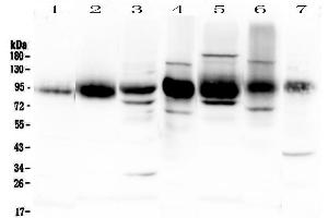 Western Blotting (WB) image for anti-Intercellular Adhesion Molecule 1 (ICAM1) (AA 28-268) antibody (ABIN5692991)