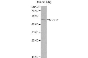Western blot analysis of extracts of mouse lung, using SKAP2 antibody. (SKAP2 antibody)