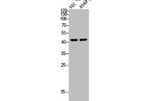 Western Blot analysis of VEC A549 cells using Cleaved-MMP-12 (G106) Polyclonal Antibody