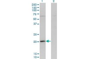 Western Blot analysis of GPSM3 expression in transfected 293T cell line by GPSM3 monoclonal antibody (M01), clone 1F11. (GPSM3 antibody  (AA 1-160))