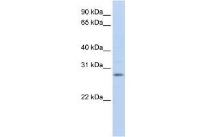 WB Suggested Anti-IGFBP4 Antibody Titration:  1 ug/ml  Positive Control:  Fetal Brain Lysate (IGFBP4 antibody  (Middle Region))