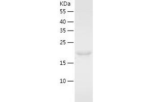 Western Blotting (WB) image for ECSIT (ECSIT) (AA 19-217) protein (His tag) (ABIN7284203) (ECSIT Protein (ECSIT) (AA 19-217) (His tag))