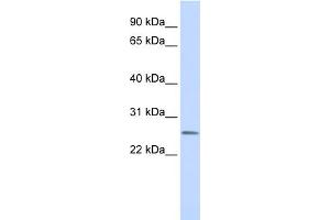 WB Suggested Anti-CEACAM4 Antibody Titration:  0. (CEACAM4 antibody  (N-Term))