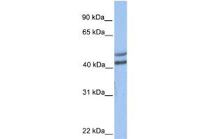 WB Suggested Anti-GALT Antibody Titration:  0. (GALT antibody  (C-Term))