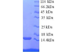 SDS-PAGE (SDS) image for Ring Finger Protein 7 (RNF7) (AA 2-113) protein (His tag) (ABIN5713794)
