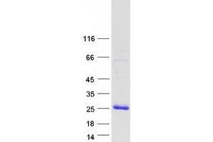 Validation with Western Blot (ARRDC1-AS1 protein (Myc-DYKDDDDK Tag))