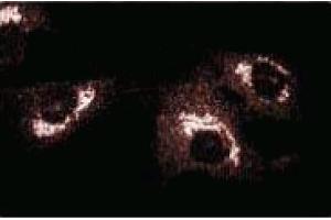 Immunofluorescence staining of BC3H1 cells (Mouse brain smooth muscle-like cells, ATCC CRL-1443). (GBF1 antibody  (AA 1266-1379))