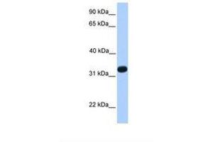 Image no. 1 for anti-Acrosomal Vesicle Protein 1 (ACRV1) (N-Term) antibody (ABIN6738860) (ACRV1 antibody  (N-Term))