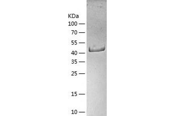 EIF4A3 Protein (AA 1-411) (His tag)