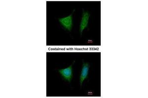 ICC/IF Image Immunofluorescence analysis of methanol-fixed HeLa, using EIF3 beta, antibody at 1:200 dilution. (EIF3I antibody)