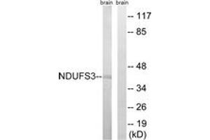 Western blot analysis of extracts from mouse brain cells, using NDUFS3 Antibody. (NDUFS3 antibody  (AA 117-166))