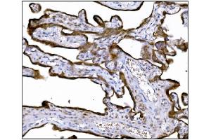 IHC analysis of LRP1B using anti-LRP1B antibody (ABIN7601521). (LRP1B antibody  (AA 3704-4547))