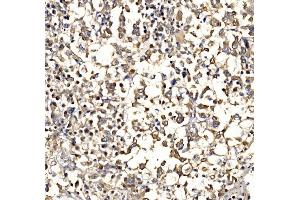 IHC analysis of Epac1/RAPGEF3 using anti-Epac1/RAPGEF3 antibody (ABIN7601858). (RAPGEF3 antibody  (AA 49-881))