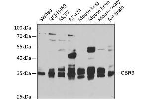 Western blot analysis of extracts of various cell lines, using CBR3 antibody  at 1:1000 dilution. (CBR3 antibody  (AA 118-277))