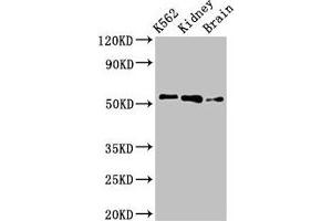 Western Blot Positive WB detected in: K562 whole cell lysate, Rat kidney tissue, Rat brain tissue All lanes: PFKFB2 antibody at 3 μg/mL Secondary Goat polyclonal to rabbit IgG at 1/50000 dilution Predicted band size: 59, 55 kDa Observed band size: 55 kDa (PFKFB2 antibody  (AA 360-505))
