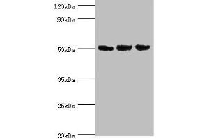 Western blot All lanes: ORC4 antibody at 4 μg/mL Lane 1: Hela whole cell lysate Lane 2: Jurkat whole cell lysate Lane 3: A549 whole cell lysate Secondary Goat polyclonal to rabbit IgG at 1/10000 dilution Predicted band size: 51, 41, 43 kDa Observed band size: 51 kDa (ORC4 antibody  (AA 187-436))