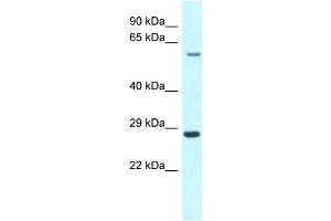 WB Suggested Anti-CPNE3 Antibody Titration: 1. (Copine III antibody  (C-Term))