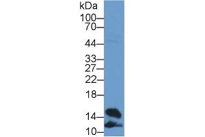 Western Blot; Sample: Rat Heart lysate; Primary Ab: 2µg/ml Rabbit Anti-Rat FABP4 Antibody Second Ab: 0. (FABP4 antibody  (AA 2-132))