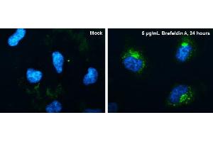 ICC/IF Image CYR61 antibody [N1C3] detects CYR61 protein at endoplasmic reticulum by immunofluorescent analysis.