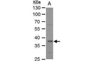 WB Image LDH-B antibody detects LDH-B protein by western blot analysis. (LDHB antibody)
